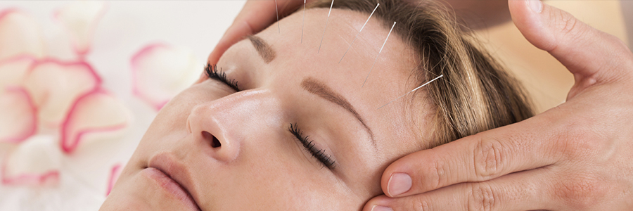 Cosmetische acupunctuur Heerenveen